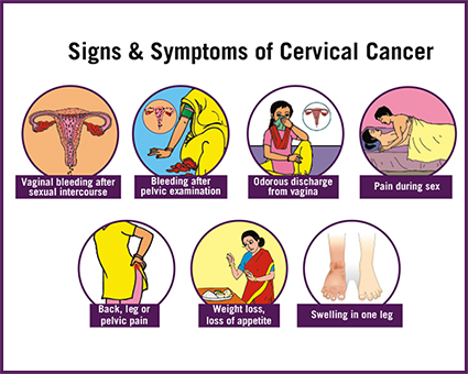 Signs and Symptoms of Cervical Cancer